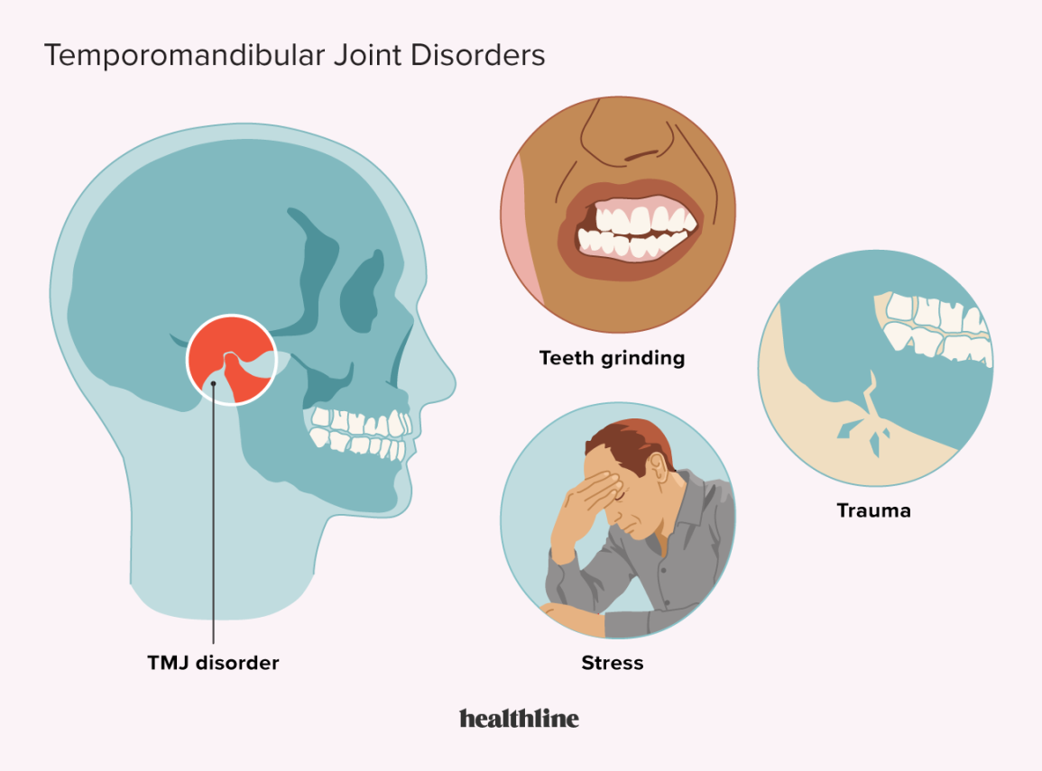 Temporomandibular joint dysfunction self-care
